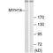 Myosin Heavy Chain 14 antibody, A04528, Boster Biological Technology, Western Blot image 