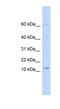 Keratin Associated Protein 8-1 antibody, NBP1-91596, Novus Biologicals, Western Blot image 