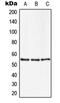 Zinc Finger And SCAN Domain Containing 22 antibody, GTX55990, GeneTex, Western Blot image 