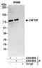 Zinc Finger Protein 358 antibody, A304-089A, Bethyl Labs, Immunoprecipitation image 