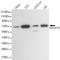 Switching B Cell Complex Subunit SWAP70 antibody, M06972, Boster Biological Technology, Western Blot image 