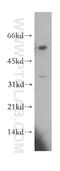 Coiled-Coil Domain Containing 28B antibody, 11530-1-AP, Proteintech Group, Western Blot image 