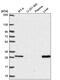 Methenyltetrahydrofolate Synthetase antibody, PA5-65845, Invitrogen Antibodies, Western Blot image 