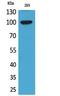 Ectonucleotide Pyrophosphatase/Phosphodiesterase 2 antibody, STJ96724, St John