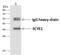 Aminoacyl TRNA Synthetase Complex Interacting Multifunctional Protein 1 antibody, GTX02201, GeneTex, Immunoprecipitation image 