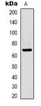 Albumin antibody, LS-C413620, Lifespan Biosciences, Western Blot image 