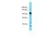 Family With Sequence Similarity 91 Member A1 antibody, A14661, Boster Biological Technology, Western Blot image 