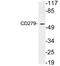 Programmed Cell Death 1 antibody, LS-C199795, Lifespan Biosciences, Western Blot image 