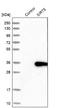 Sirtuin 5 antibody, NBP1-86004, Novus Biologicals, Western Blot image 