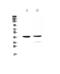 Cathepsin D antibody, PA5-79093, Invitrogen Antibodies, Western Blot image 