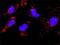 MAPK Activated Protein Kinase 2 antibody, H00009261-M01, Novus Biologicals, Proximity Ligation Assay image 