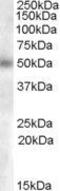 Beta-1,3-galactosyl-O-glycosyl-glycoprotein beta-1,6-N-acetylglucosaminyltransferase 3 antibody, GTX88861, GeneTex, Western Blot image 