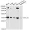 Ribosomal Protein L7a antibody, A14060, ABclonal Technology, Western Blot image 