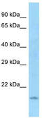 WD Repeat Domain 37 antibody, TA334491, Origene, Western Blot image 