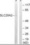 Solute Carrier Family 28 Member 2 antibody, PA5-39468, Invitrogen Antibodies, Western Blot image 