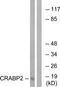 Cellular Retinoic Acid Binding Protein 2 antibody, TA313145, Origene, Western Blot image 