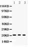O-6-Methylguanine-DNA Methyltransferase antibody, LS-C357431, Lifespan Biosciences, Western Blot image 