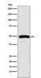 Actin Related Protein 3 antibody, M03423-1, Boster Biological Technology, Western Blot image 