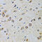 Cyclin Dependent Kinase 1 antibody, 13-084, ProSci, Immunohistochemistry paraffin image 