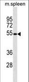 Mitochondrial Antiviral Signaling Protein antibody, LS-C157922, Lifespan Biosciences, Western Blot image 