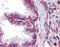 Metadherin antibody, 51-383, ProSci, Immunohistochemistry paraffin image 