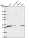 Coiled-Coil Domain Containing 69 antibody, NBP2-55589, Novus Biologicals, Western Blot image 