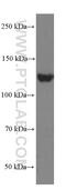 EPH Receptor A7 antibody, 66667-1-Ig, Proteintech Group, Western Blot image 
