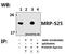 Mitochondrial Ribosomal Protein S25 antibody, A14080S25, Boster Biological Technology, Western Blot image 