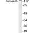 Calcium Voltage-Gated Channel Auxiliary Subunit Alpha2delta 1 antibody, A04282-2, Boster Biological Technology, Western Blot image 