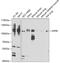 Dipeptidyl Peptidase 8 antibody, GTX65827, GeneTex, Western Blot image 