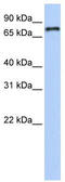 Nuclear Receptor Subfamily 1 Group D Member 1 antibody, TA338008, Origene, Western Blot image 