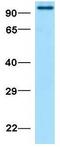 Sad1 And UNC84 Domain Containing 1 antibody, GTX45959, GeneTex, Western Blot image 