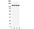 MER Proto-Oncogene, Tyrosine Kinase antibody, R31400, NSJ Bioreagents, Western Blot image 