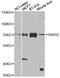 Aspartyl-TRNA Synthetase 2, Mitochondrial antibody, A4814, ABclonal Technology, Western Blot image 