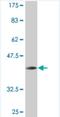 CBFA2/RUNX1 Partner Transcriptional Co-Repressor 2 antibody, H00009139-M06, Novus Biologicals, Western Blot image 
