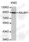 RALBP1 antibody, A0571, ABclonal Technology, Western Blot image 