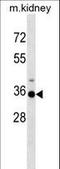 Homeobox A3 antibody, LS-C158203, Lifespan Biosciences, Western Blot image 