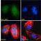 Tigger Transposable Element Derived 1 antibody, 46-494, ProSci, Enzyme Linked Immunosorbent Assay image 