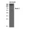 Rho Associated Coiled-Coil Containing Protein Kinase 2 antibody, LS-C385938, Lifespan Biosciences, Western Blot image 