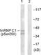 Heterogeneous Nuclear Ribonucleoprotein C (C1/C2) antibody, PA5-38589, Invitrogen Antibodies, Western Blot image 