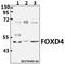 Forkhead Box D4 antibody, A13010-1, Boster Biological Technology, Western Blot image 