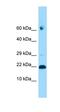 Adenosine Deaminase TRNA Specific 2 antibody, orb326609, Biorbyt, Western Blot image 