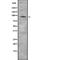 Phosphatidylinositol 4-Kinase Beta antibody, abx217758, Abbexa, Western Blot image 