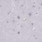 Phosphodiesterase 6A antibody, NBP2-68985, Novus Biologicals, Immunohistochemistry paraffin image 