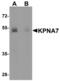 Karyopherin Subunit Alpha 7 antibody, LS-B4729, Lifespan Biosciences, Western Blot image 