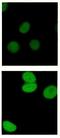 Pan Acetylated-Lysine  antibody, 251118, Abbiotec, Immunofluorescence image 