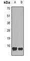 C-C Motif Chemokine Ligand 28 antibody, abx225078, Abbexa, Western Blot image 