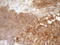 Fascin Actin-Bundling Protein 1 antibody, LS-C791177, Lifespan Biosciences, Immunohistochemistry paraffin image 