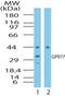 Complement Component 5a Receptor 2 antibody, TA336368, Origene, Western Blot image 