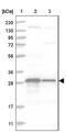Thioredoxin Domain Containing 9 antibody, NBP1-89051, Novus Biologicals, Western Blot image 